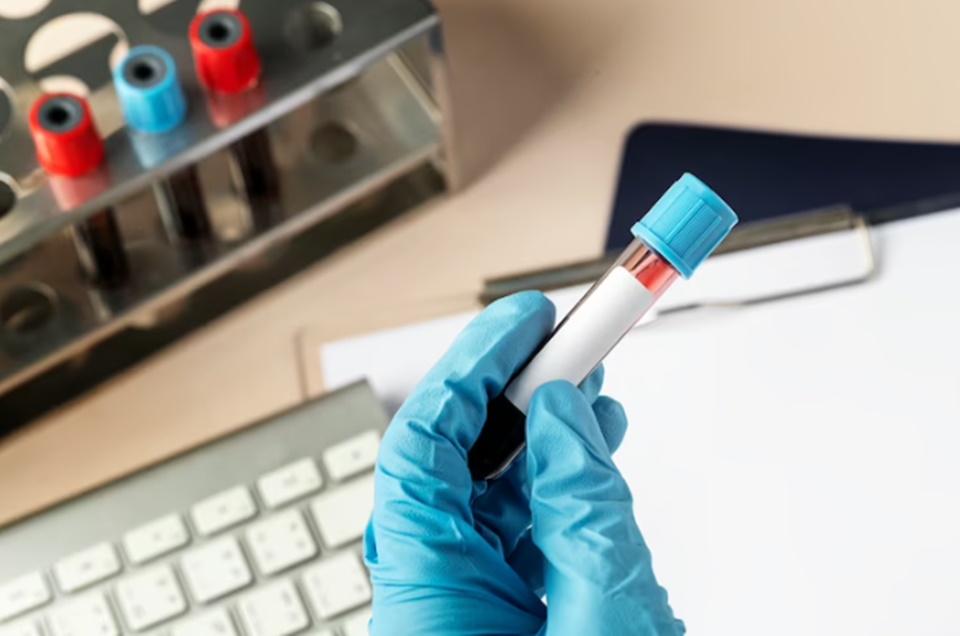 Nova era na Farmácia Clínica: Anvisa libera a realização de exames laboratoriais em Farmácias e Drogarias
