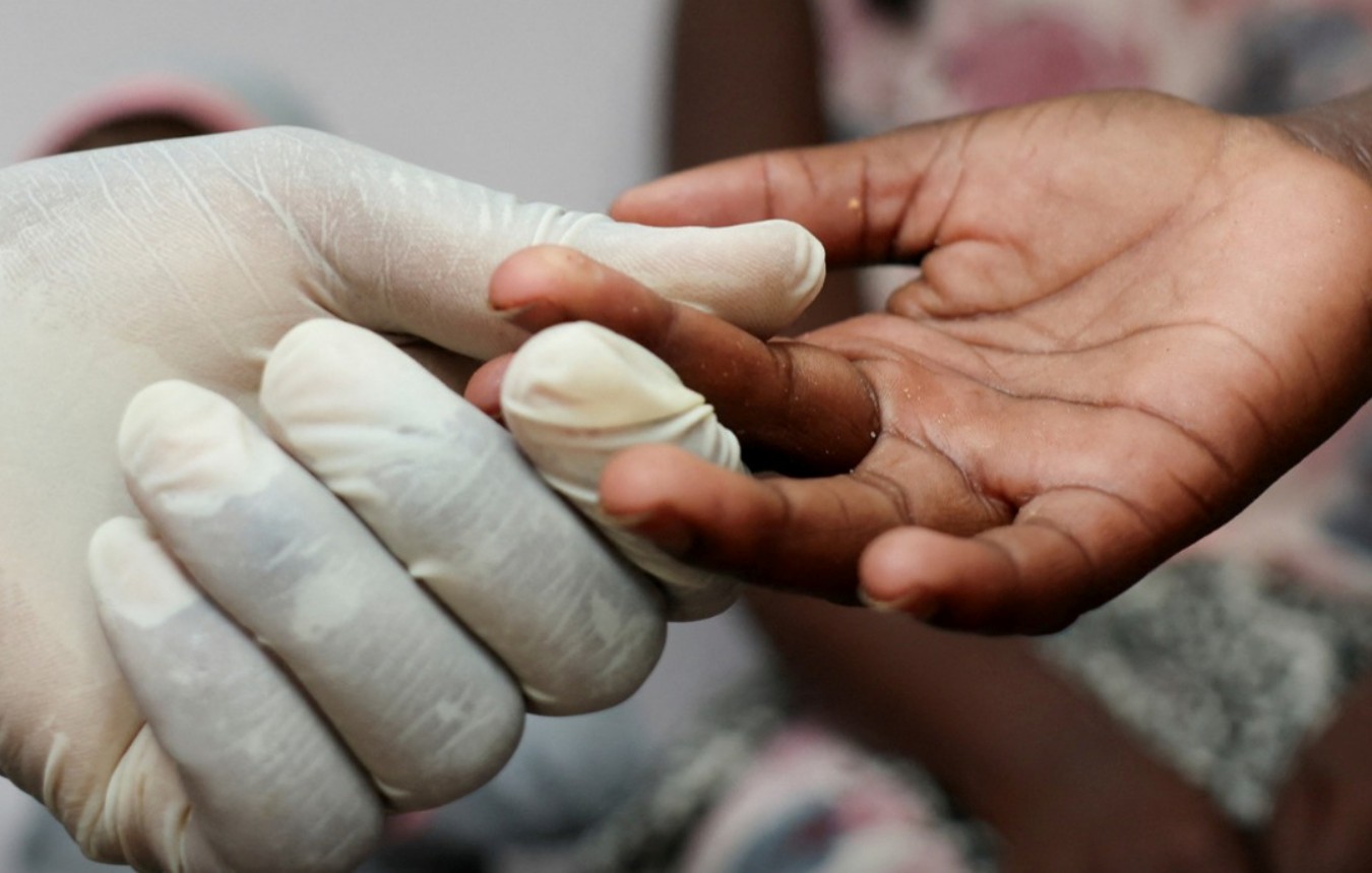 Brasil elimina transmissão vertical do HIV, da mãe para o bebê, e alcança menor taxa de mortalidade dos últimos anos