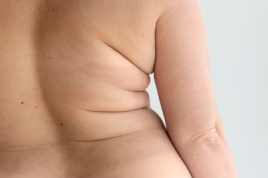 Estudo revela que melatonina pode proteger contra obesidade ao regular gordura visceral