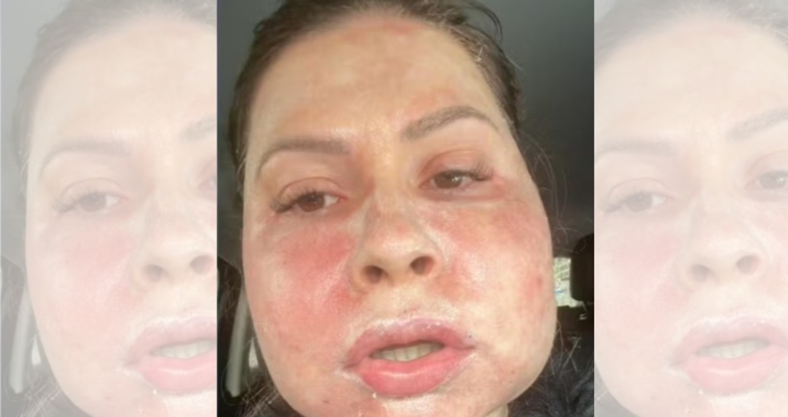 Farmacêutico e médica se defendem judicialmente, após denúncia de deformidade facial de paciente