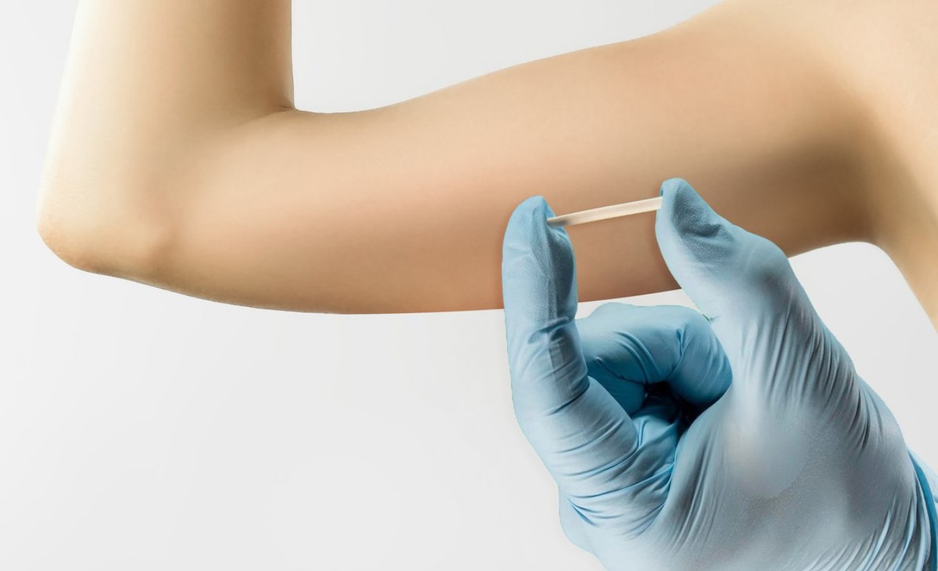 Implante anticoncepcional impulsiona crescimento recorde da organon no brasil