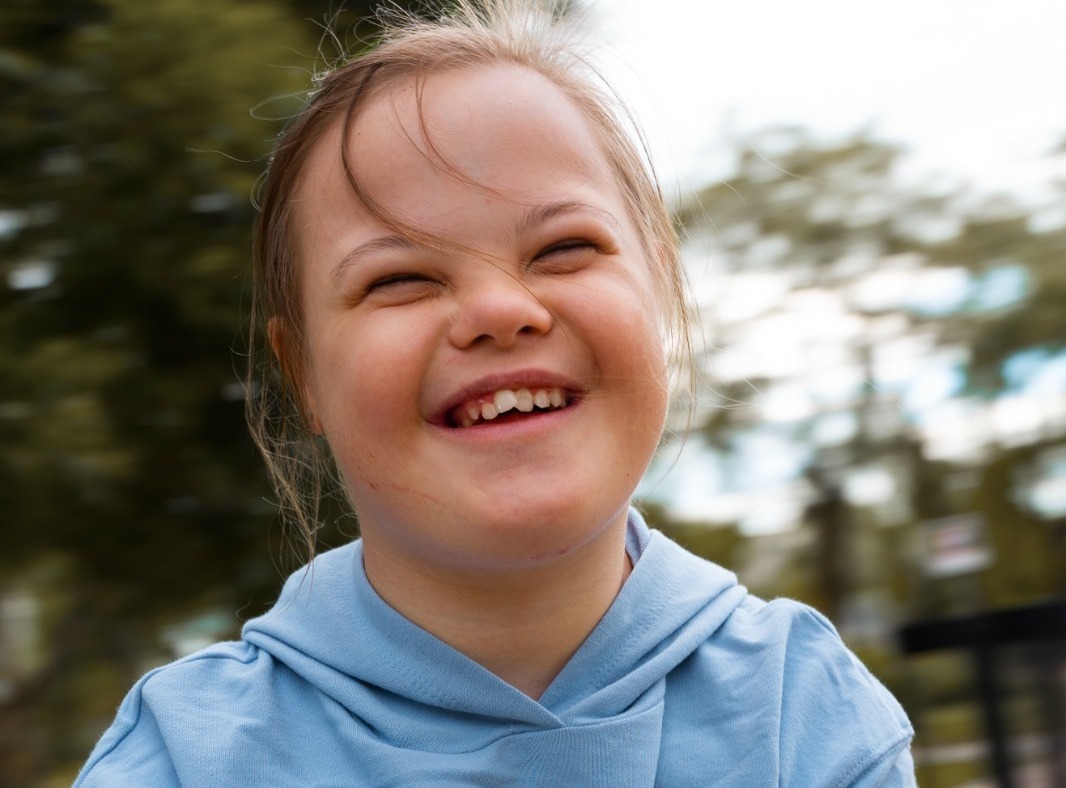 Pesquisadores fazem história com descoberta que pode mudar o tratamento da síndrome de down