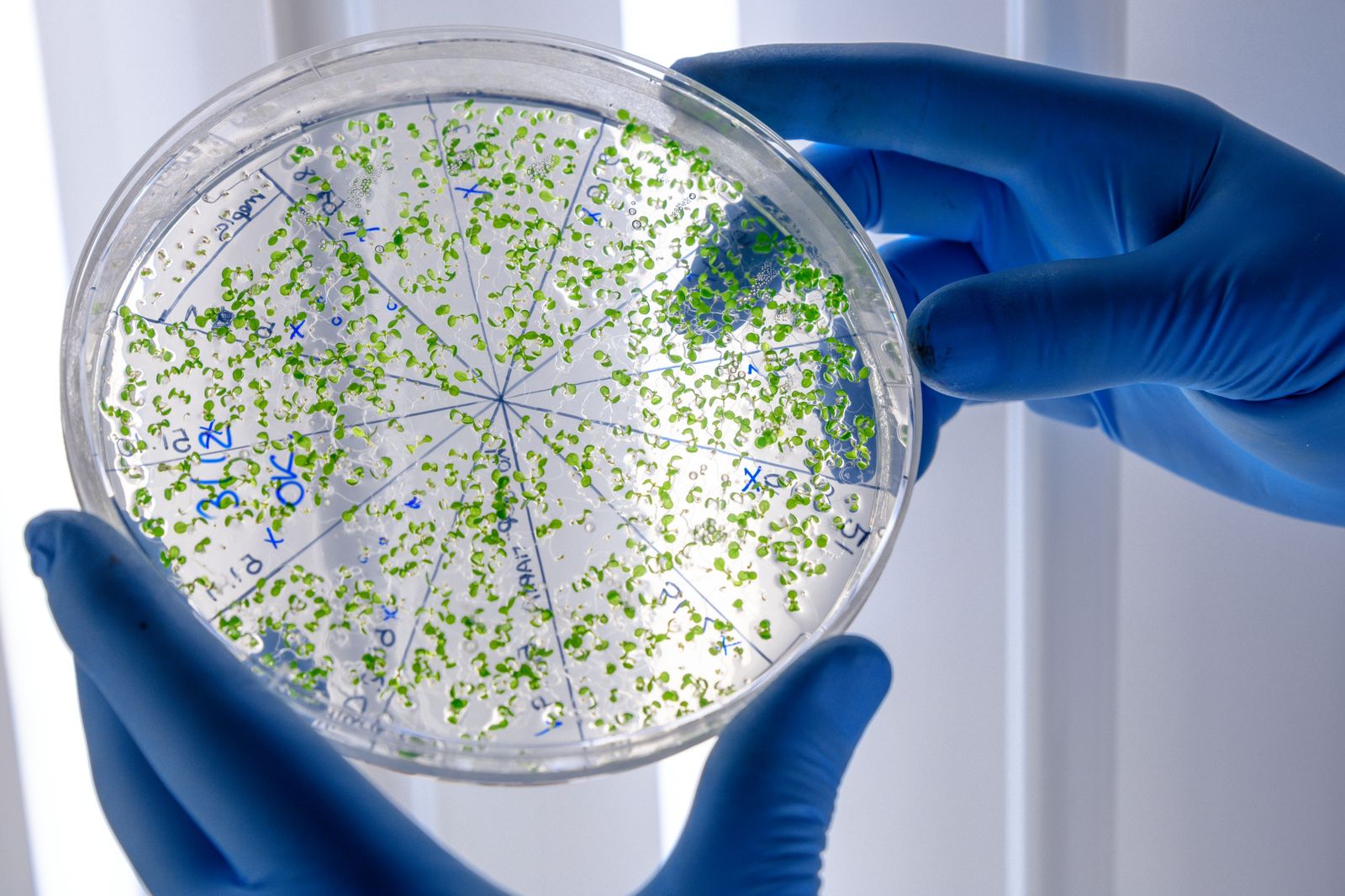 Superbactéria entre as mais perigosas do mundo expõe risco e desafio clínico em UTI neonatal