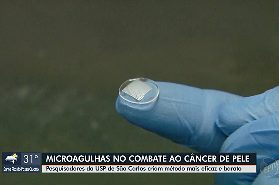 USP desenvolve nova técnica com microagulhas para tratar câncer de pele