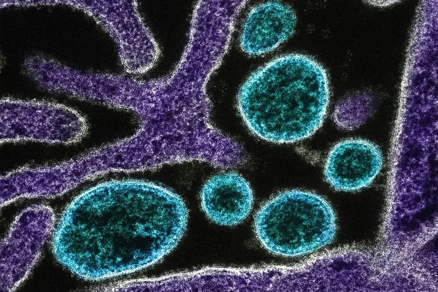 OMS avalia como baixo o risco de disseminação do vírus Nipah fora da Índia