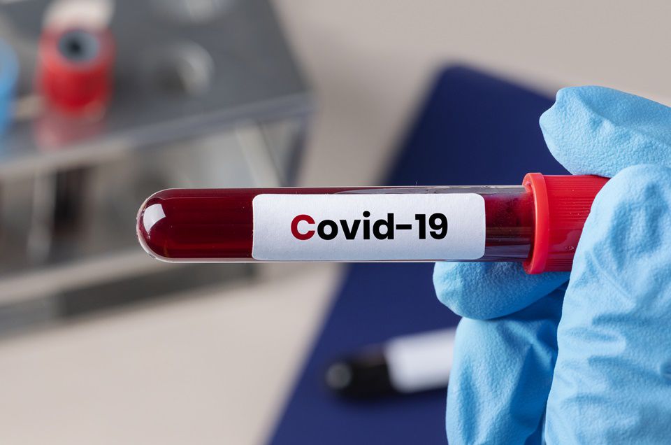 Inédito: mulher fica 152 dias com Covid-19 sem apresentar sintomas no Brasil 