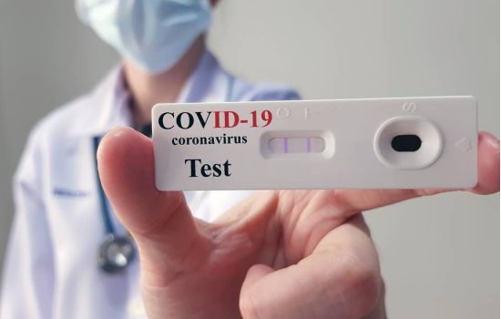 Vendas de testes de farmácias para detectar Covid-19 já superam 2020