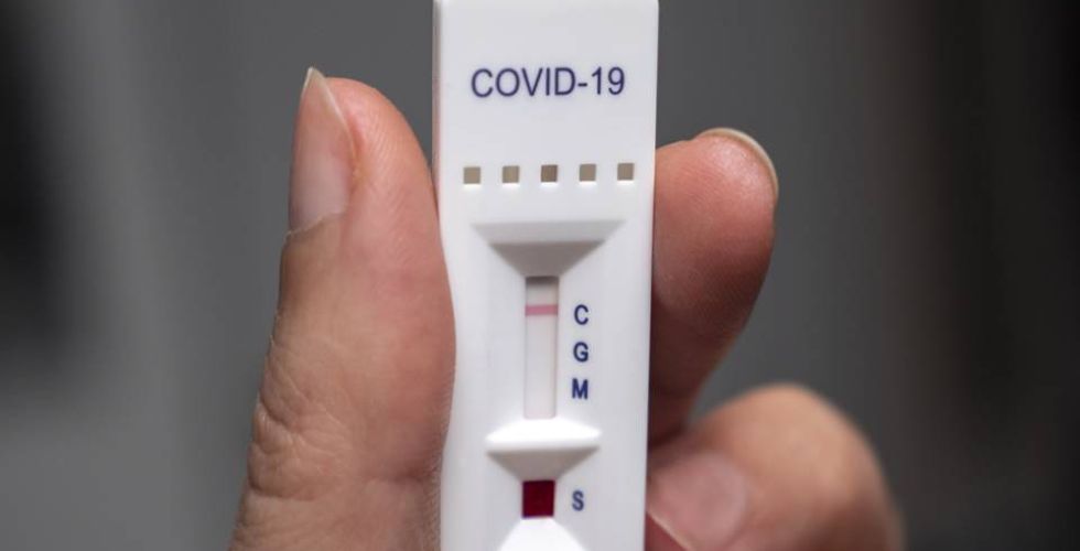 Covid-19: por que o teste rápido da farmácia vai dar errado